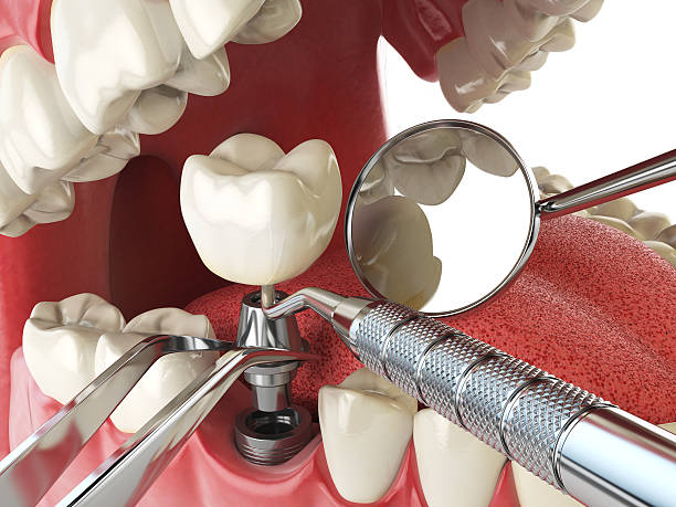 Best Emergency Care for Gum Disease in Montgomery Village, MD